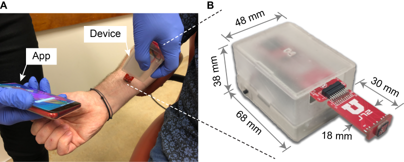 Skin cancer sensor designed by the Sanchez Research Lab